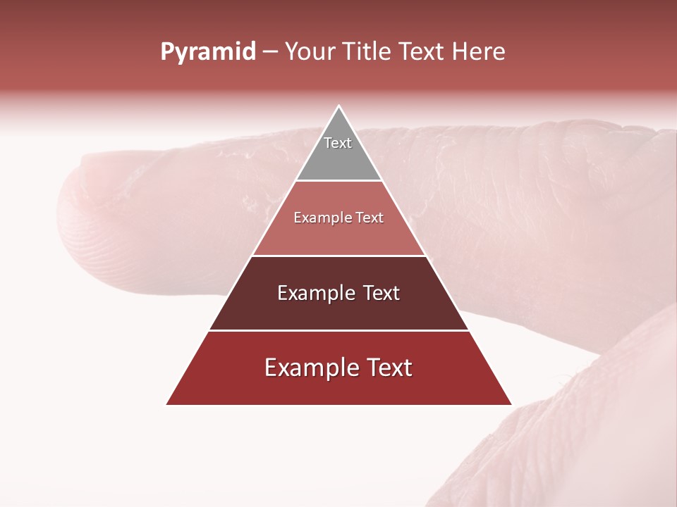 Closeup Of Eczema On Male Finger With Skin Peeling PowerPoint Template