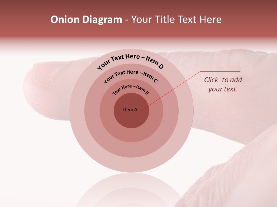 Closeup Of Eczema On Male Finger With Skin Peeling PowerPoint Template