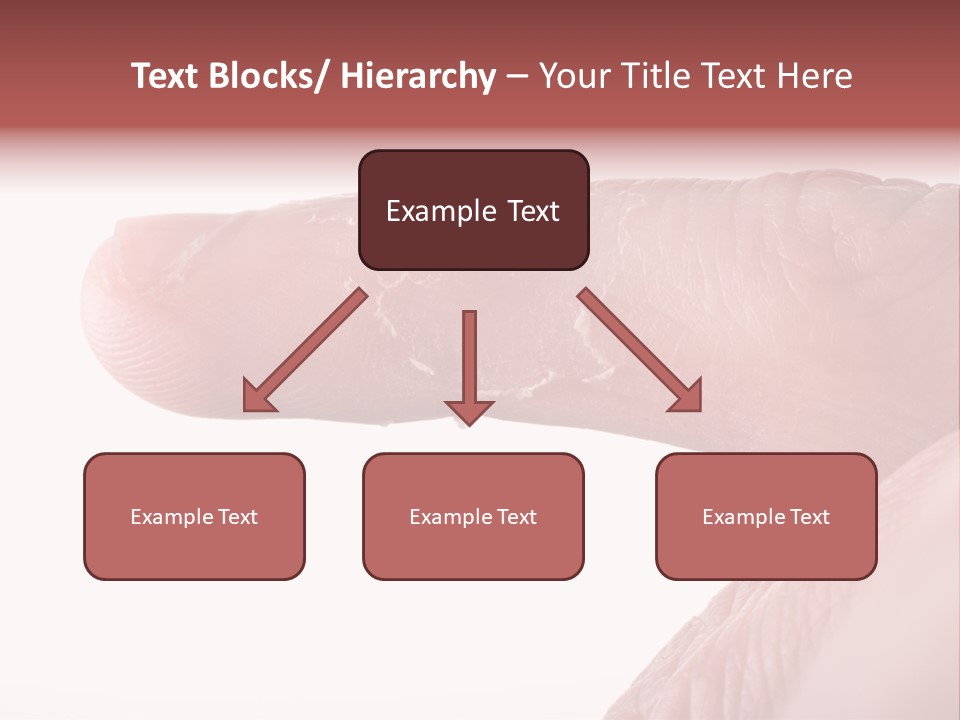 Closeup Of Eczema On Male Finger With Skin Peeling PowerPoint Template