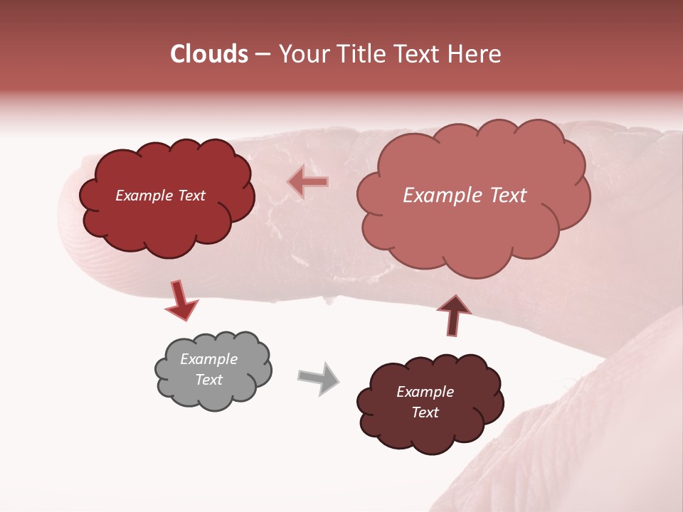 Closeup Of Eczema On Male Finger With Skin Peeling PowerPoint Template