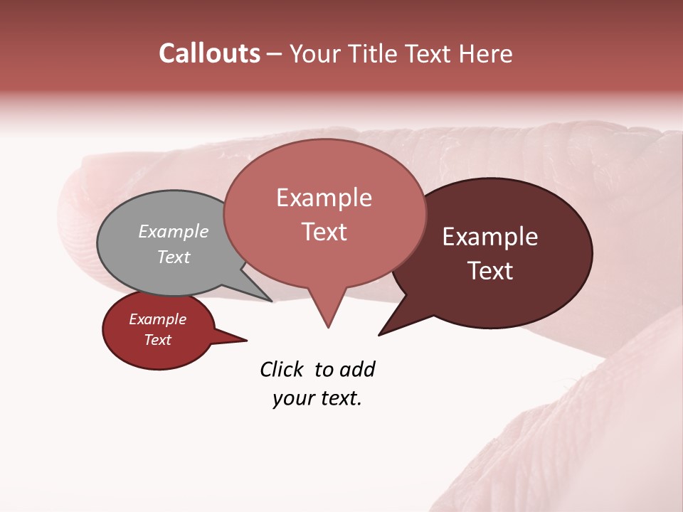 Closeup Of Eczema On Male Finger With Skin Peeling PowerPoint Template