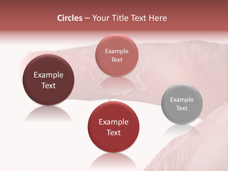 Closeup Of Eczema On Male Finger With Skin Peeling PowerPoint Template