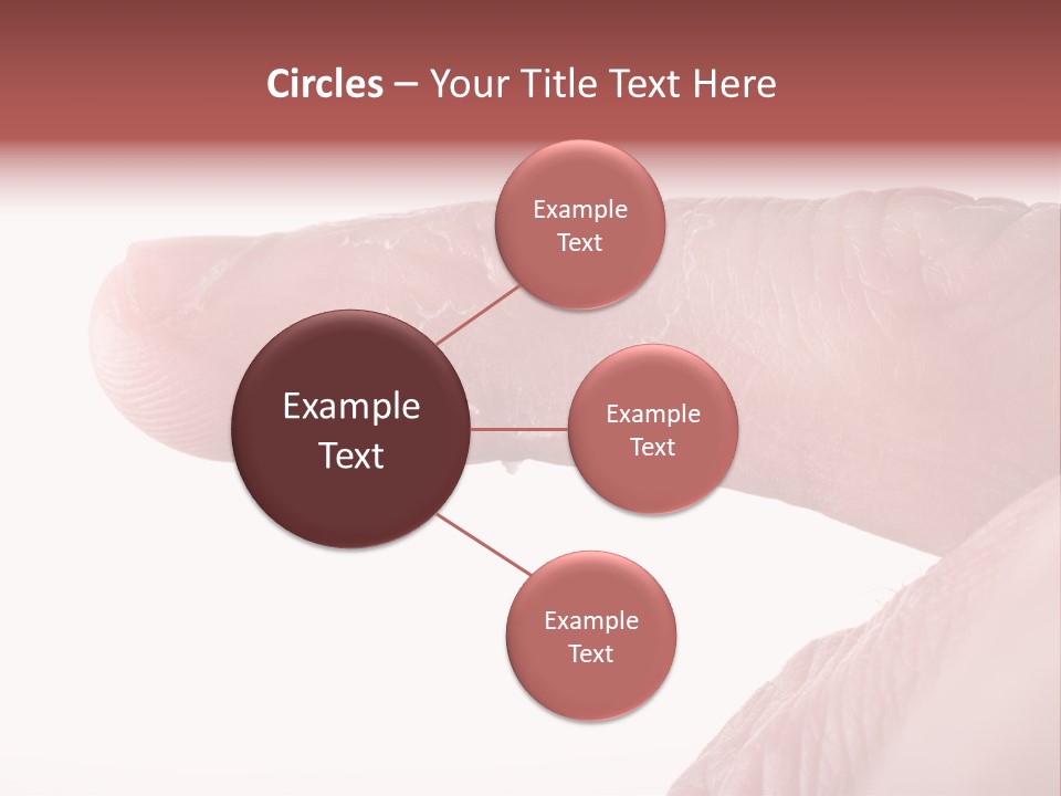 Closeup Of Eczema On Male Finger With Skin Peeling PowerPoint Template