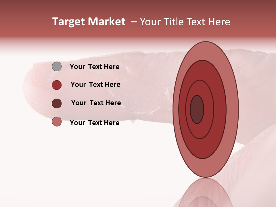 Closeup Of Eczema On Male Finger With Skin Peeling PowerPoint Template