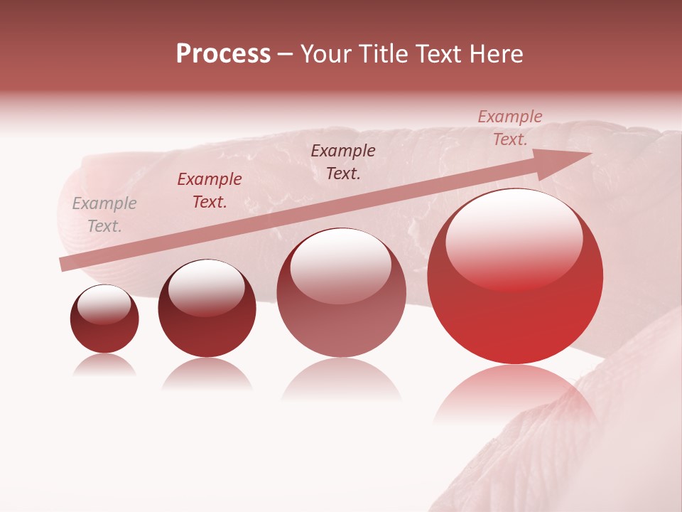 Closeup Of Eczema On Male Finger With Skin Peeling PowerPoint Template