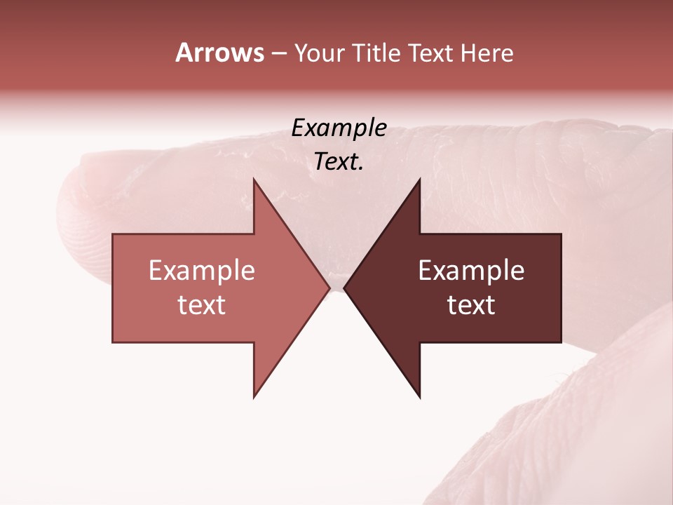 Closeup Of Eczema On Male Finger With Skin Peeling PowerPoint Template