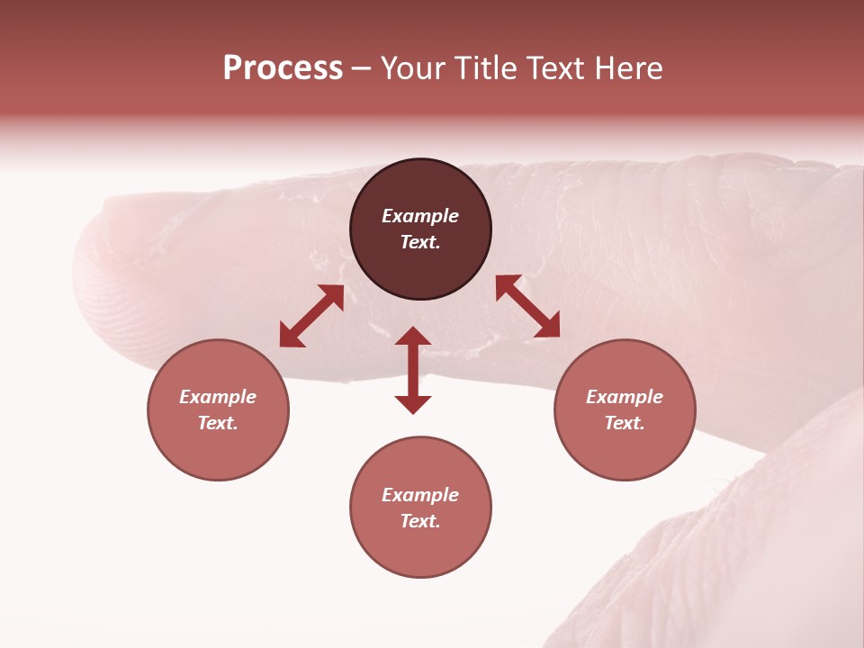 Closeup Of Eczema On Male Finger With Skin Peeling PowerPoint Template