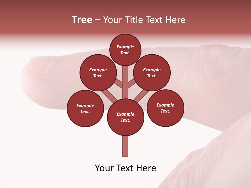 Closeup Of Eczema On Male Finger With Skin Peeling PowerPoint Template