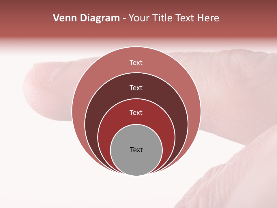Closeup Of Eczema On Male Finger With Skin Peeling PowerPoint Template
