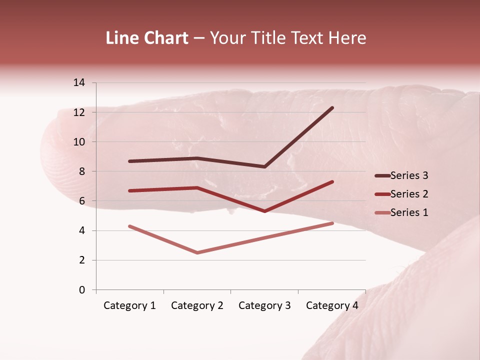 Closeup Of Eczema On Male Finger With Skin Peeling PowerPoint Template