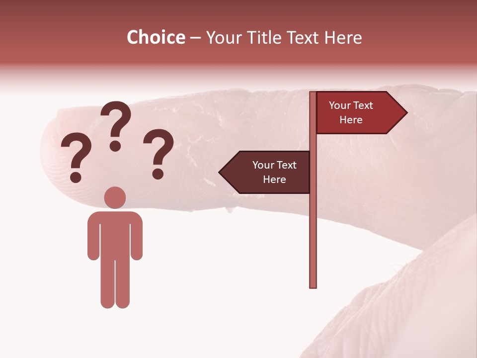 Closeup Of Eczema On Male Finger With Skin Peeling PowerPoint Template