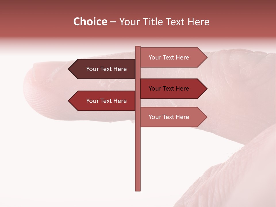 Closeup Of Eczema On Male Finger With Skin Peeling PowerPoint Template