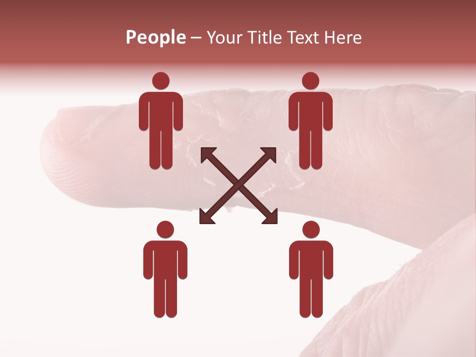 Closeup Of Eczema On Male Finger With Skin Peeling PowerPoint Template