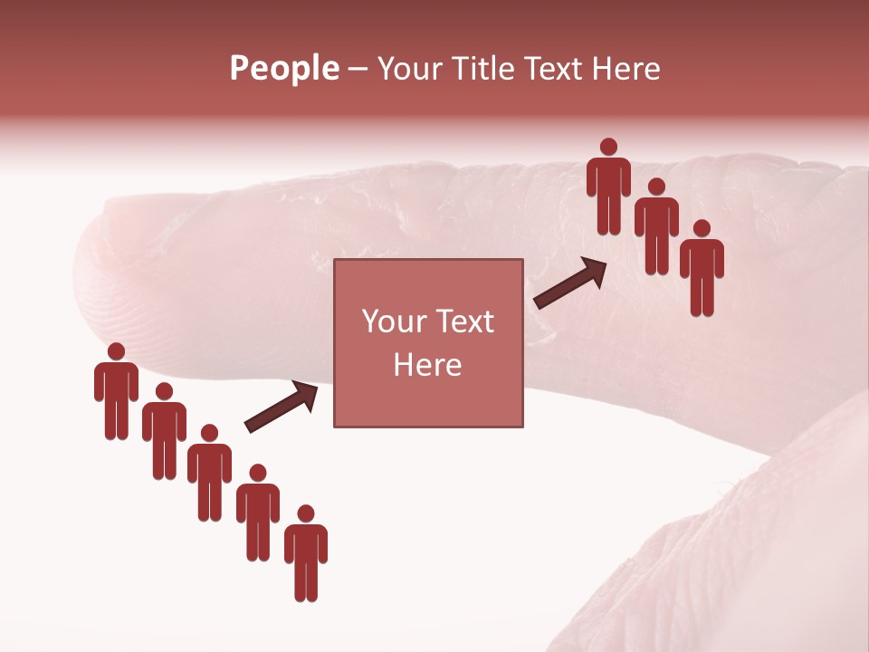 Closeup Of Eczema On Male Finger With Skin Peeling PowerPoint Template