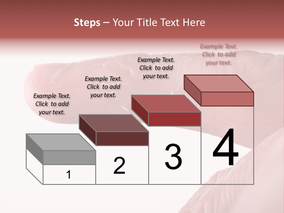 Closeup Of Eczema On Male Finger With Skin Peeling PowerPoint Template