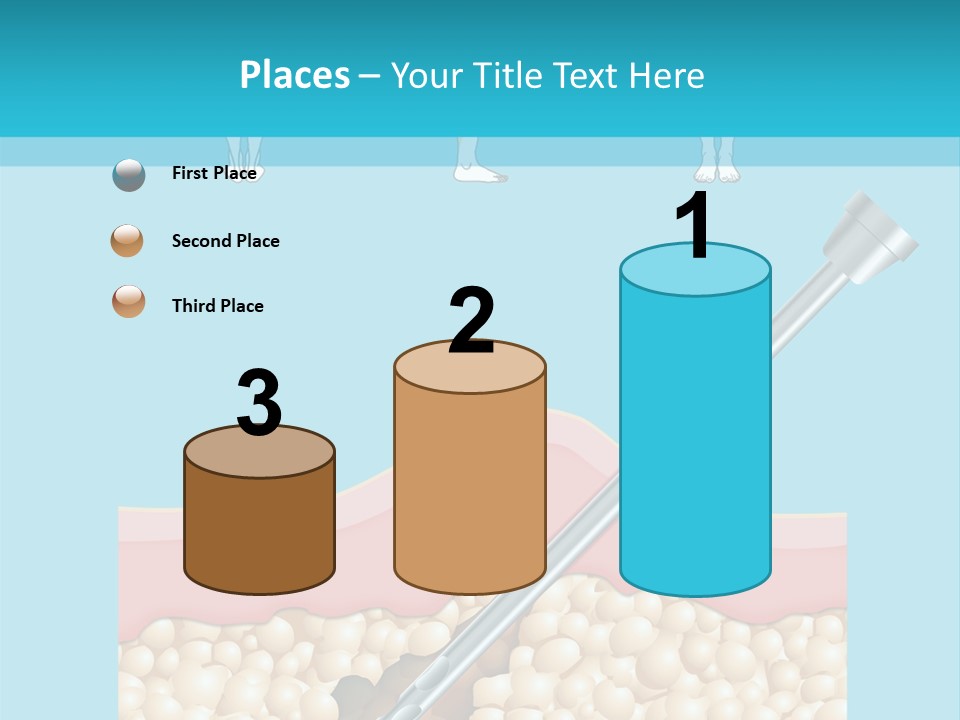 Illustration Of Liposuction Intervention With Liposculpture In A Woman PowerPoint Template