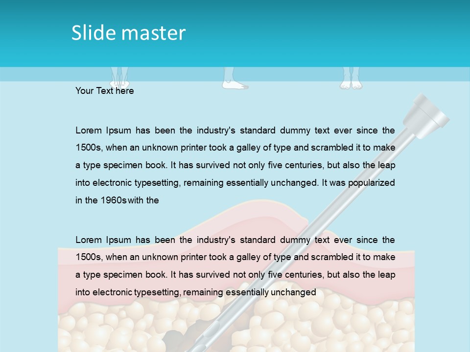 Illustration Of Liposuction Intervention With Liposculpture In A Woman PowerPoint Template