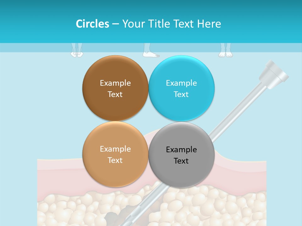 Illustration Of Liposuction Intervention With Liposculpture In A Woman PowerPoint Template