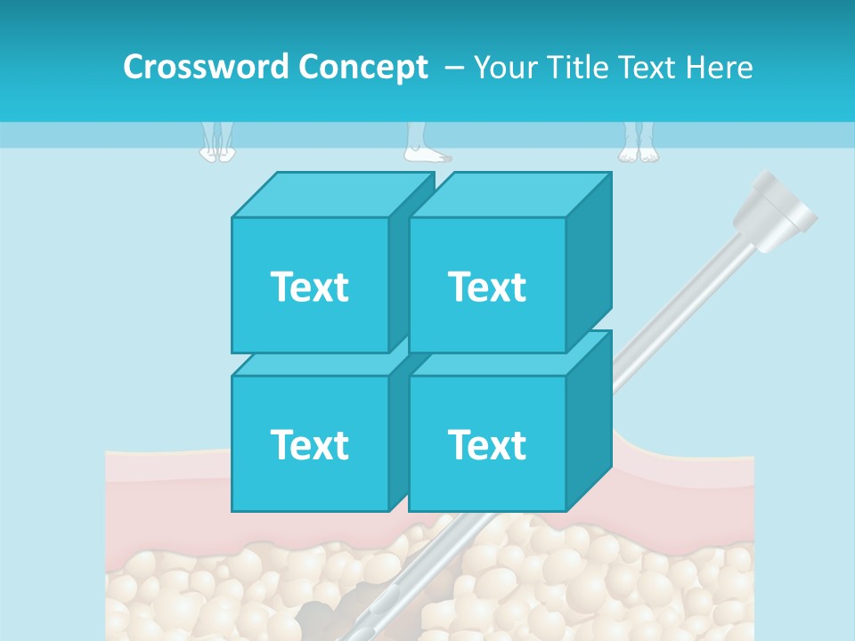Illustration Of Liposuction Intervention With Liposculpture In A Woman PowerPoint Template