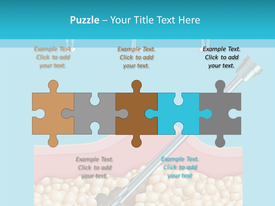 Illustration Of Liposuction Intervention With Liposculpture In A Woman PowerPoint Template