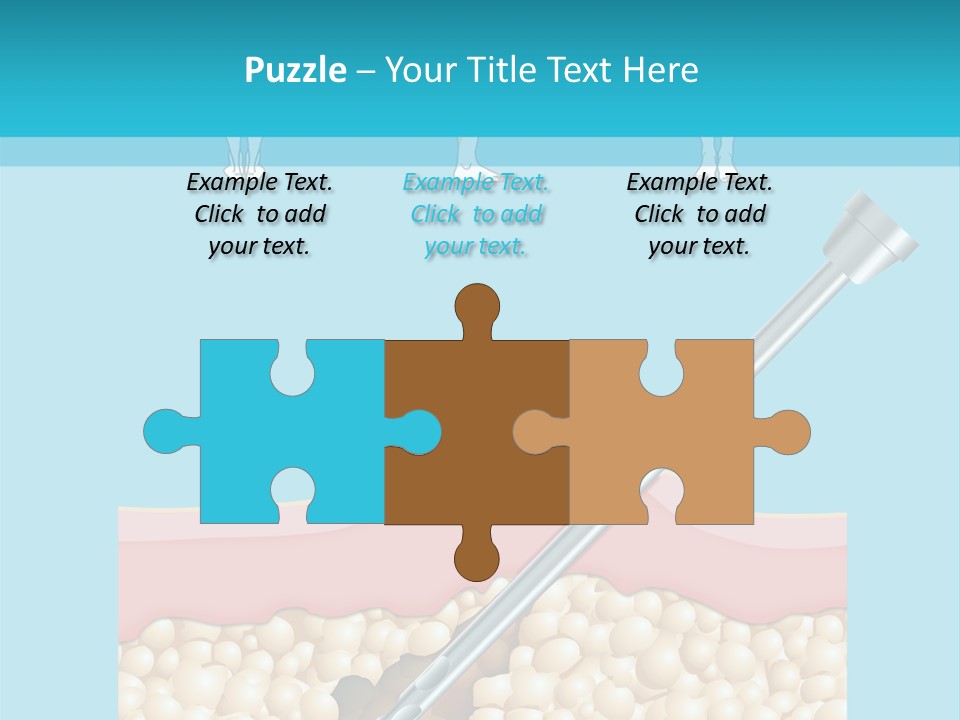 Illustration Of Liposuction Intervention With Liposculpture In A Woman PowerPoint Template