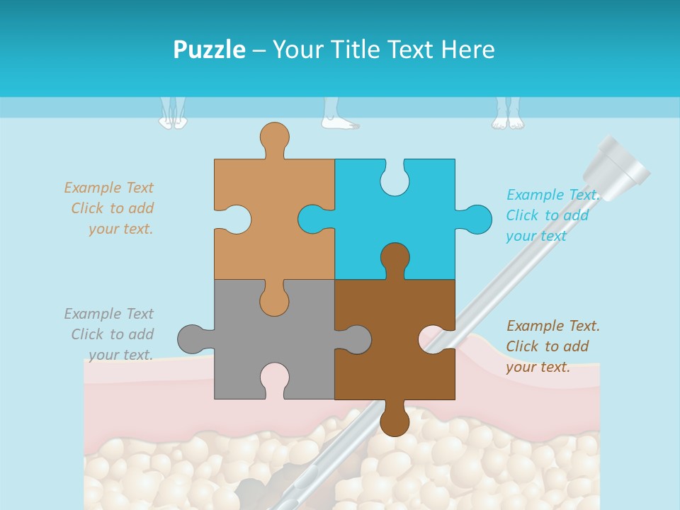 Illustration Of Liposuction Intervention With Liposculpture In A Woman PowerPoint Template