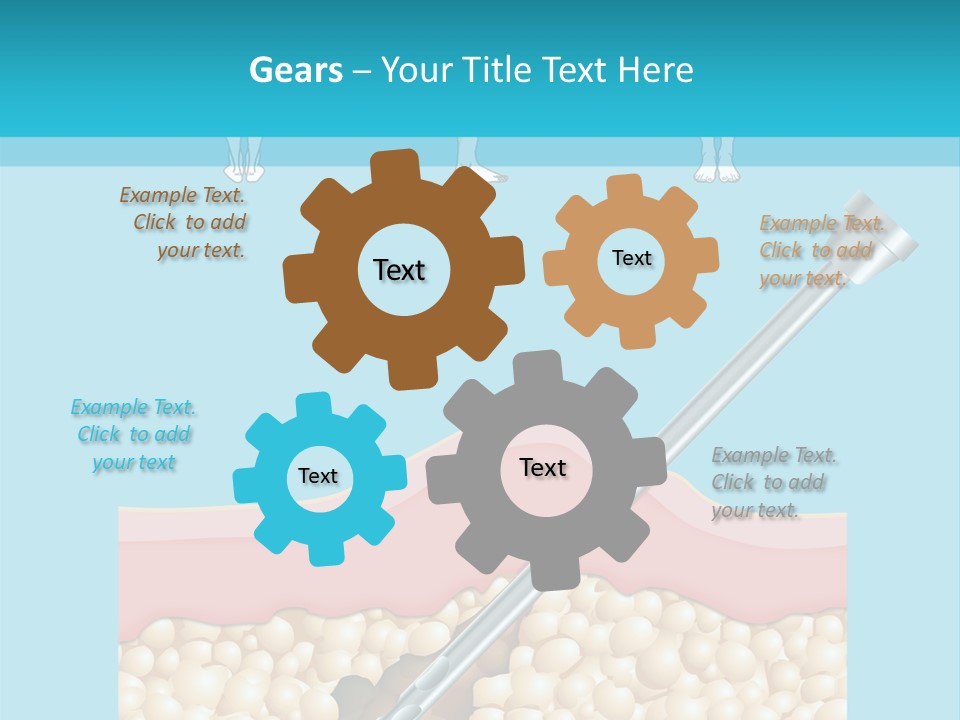 Illustration Of Liposuction Intervention With Liposculpture In A Woman PowerPoint Template