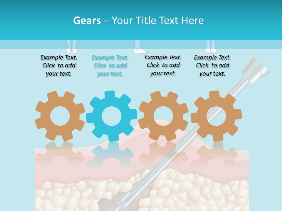 Illustration Of Liposuction Intervention With Liposculpture In A Woman PowerPoint Template