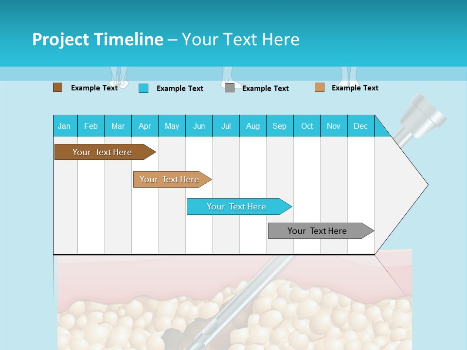 Illustration Of Liposuction Intervention With Liposculpture In A Woman PowerPoint Template