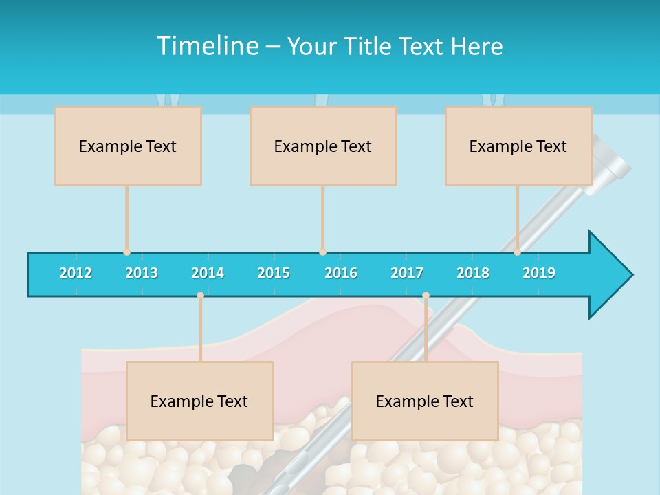 Illustration Of Liposuction Intervention With Liposculpture In A Woman PowerPoint Template