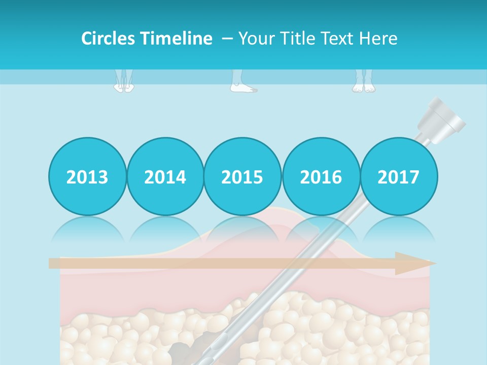 Illustration Of Liposuction Intervention With Liposculpture In A Woman PowerPoint Template