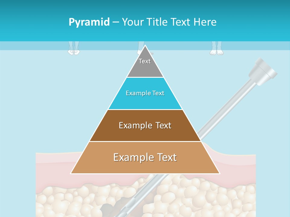 Illustration Of Liposuction Intervention With Liposculpture In A Woman PowerPoint Template
