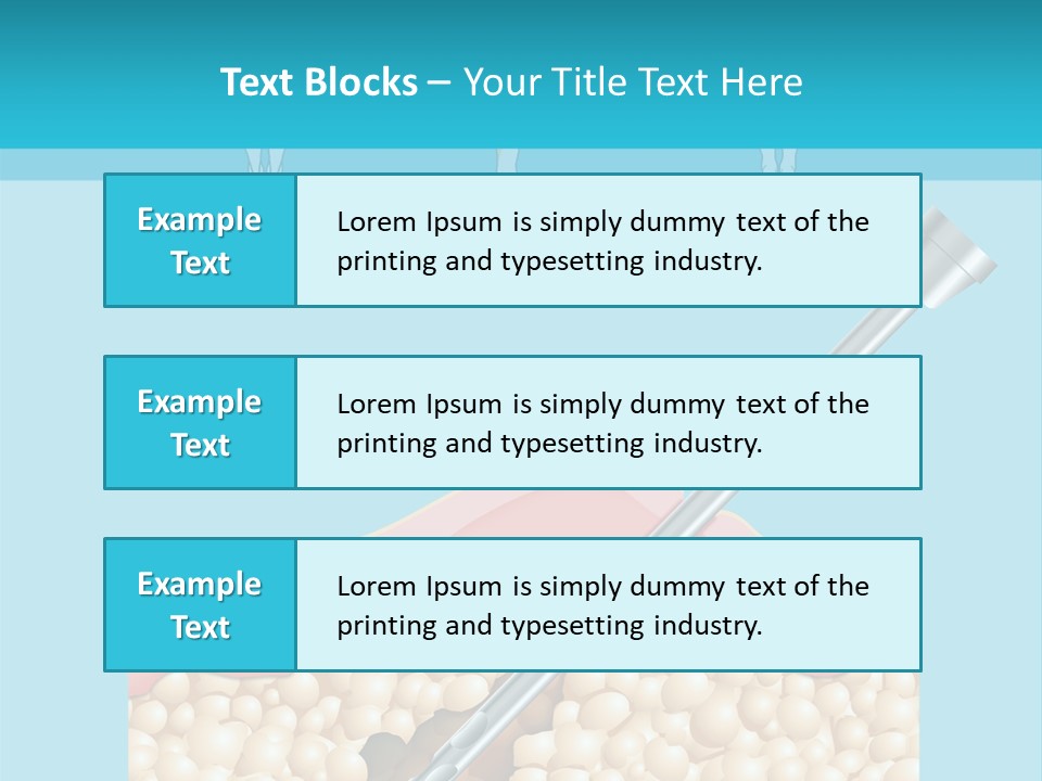 Illustration Of Liposuction Intervention With Liposculpture In A Woman PowerPoint Template