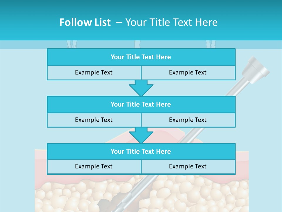 Illustration Of Liposuction Intervention With Liposculpture In A Woman PowerPoint Template