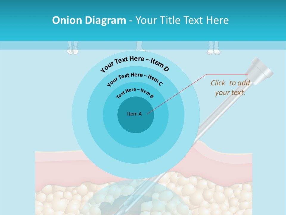Illustration Of Liposuction Intervention With Liposculpture In A Woman PowerPoint Template
