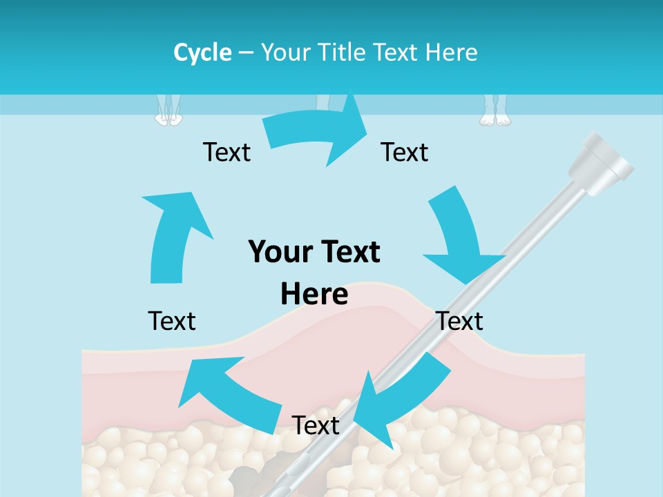 Illustration Of Liposuction Intervention With Liposculpture In A Woman PowerPoint Template