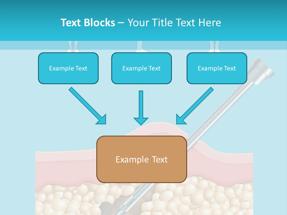 Illustration Of Liposuction Intervention With Liposculpture In A Woman PowerPoint Template