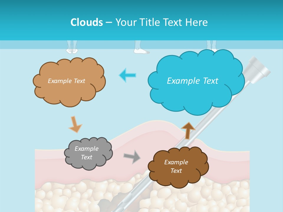 Illustration Of Liposuction Intervention With Liposculpture In A Woman PowerPoint Template