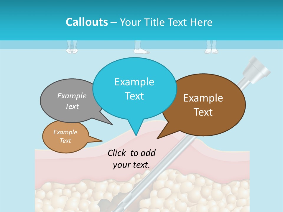 Illustration Of Liposuction Intervention With Liposculpture In A Woman PowerPoint Template
