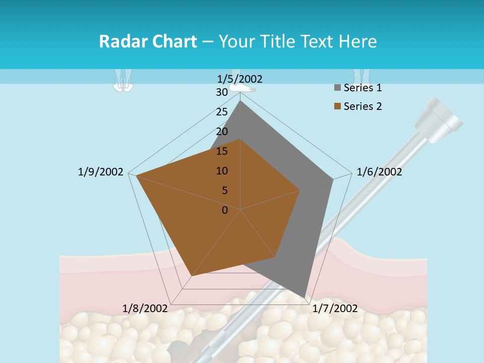 Illustration Of Liposuction Intervention With Liposculpture In A Woman PowerPoint Template