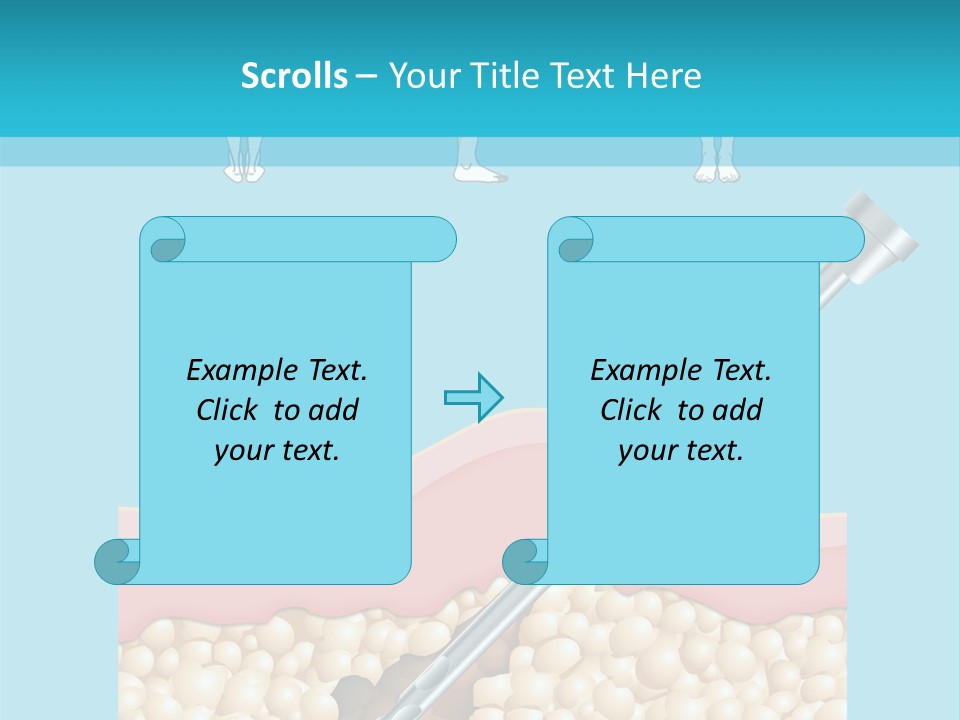 Illustration Of Liposuction Intervention With Liposculpture In A Woman PowerPoint Template