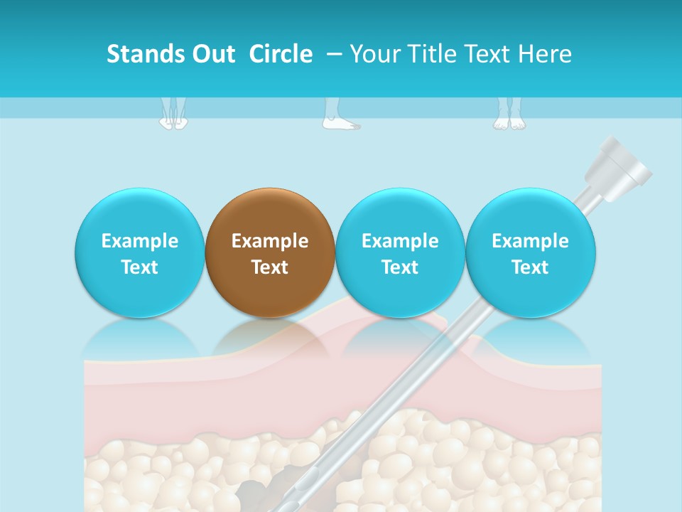 Illustration Of Liposuction Intervention With Liposculpture In A Woman PowerPoint Template