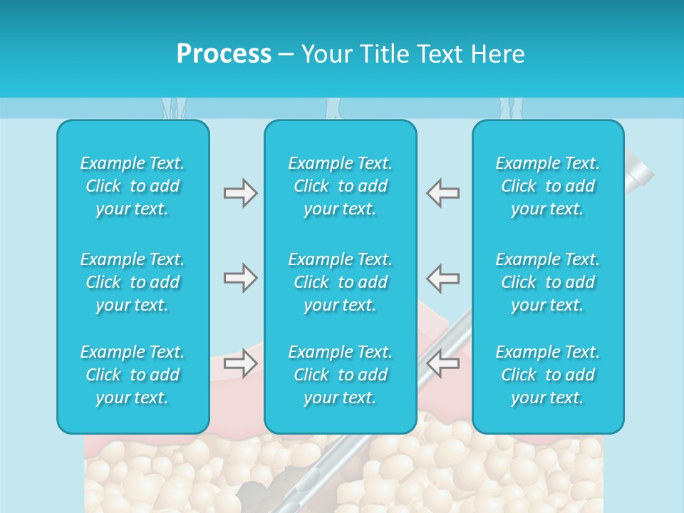 Illustration Of Liposuction Intervention With Liposculpture In A Woman PowerPoint Template