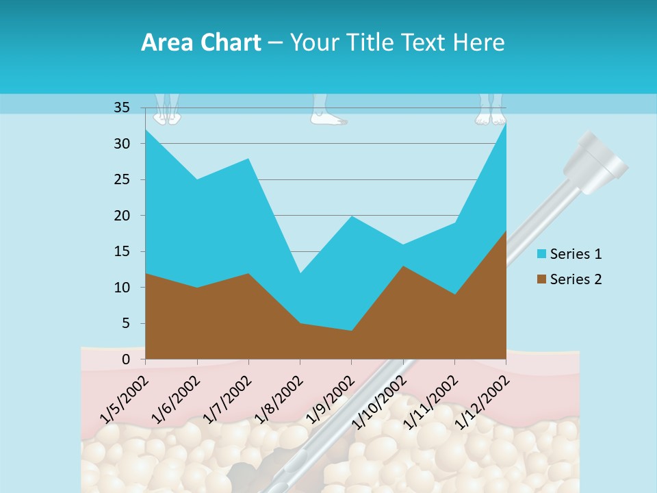 Illustration Of Liposuction Intervention With Liposculpture In A Woman PowerPoint Template