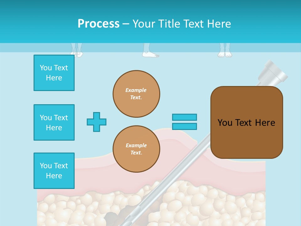 Illustration Of Liposuction Intervention With Liposculpture In A Woman PowerPoint Template
