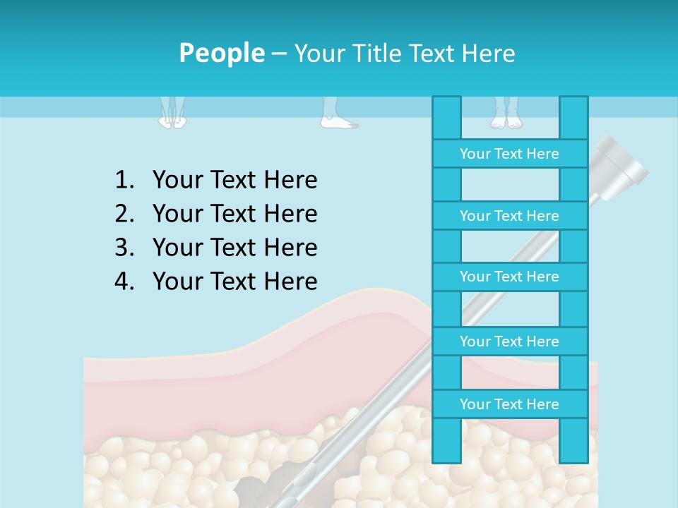 Illustration Of Liposuction Intervention With Liposculpture In A Woman PowerPoint Template