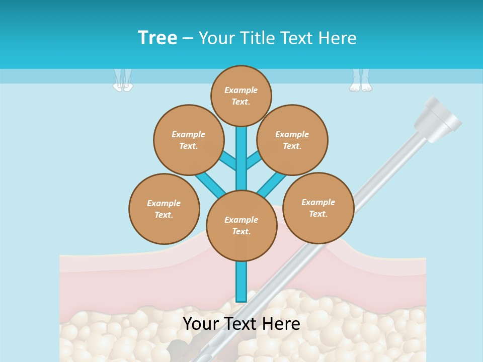 Illustration Of Liposuction Intervention With Liposculpture In A Woman PowerPoint Template