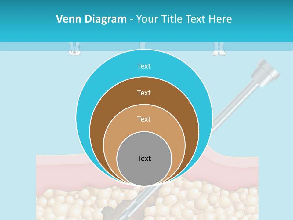 Illustration Of Liposuction Intervention With Liposculpture In A Woman PowerPoint Template
