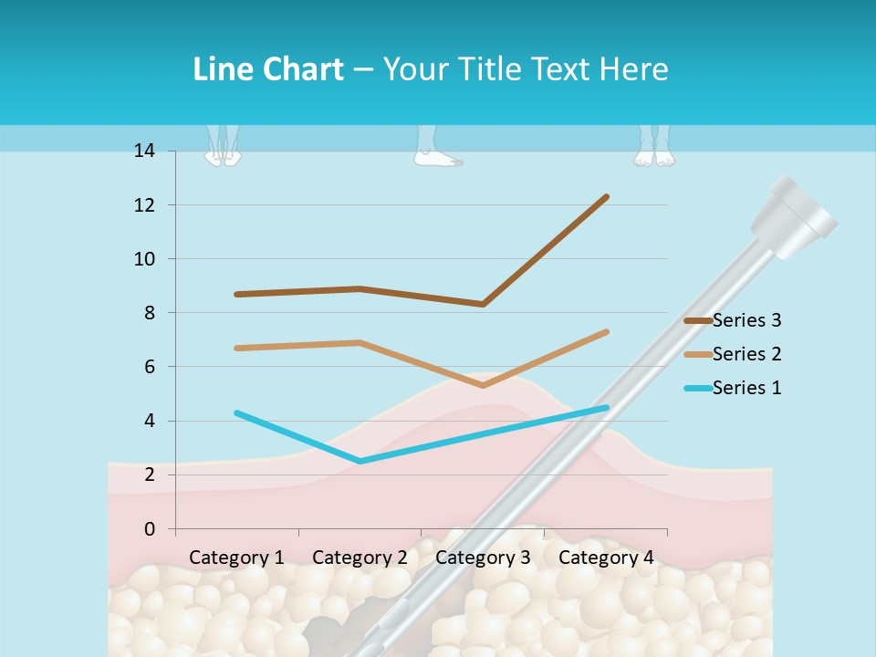 Illustration Of Liposuction Intervention With Liposculpture In A Woman PowerPoint Template