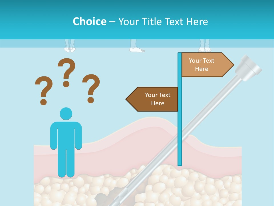 Illustration Of Liposuction Intervention With Liposculpture In A Woman PowerPoint Template